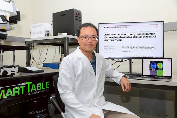 全球首創氧化壓力偵測技術　中山大學研究有望緩解阿茲海默症1